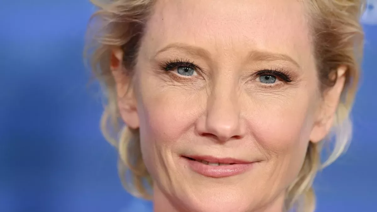Anne Heche had to wait for 45 minutes before she could get any lifesaving measures 