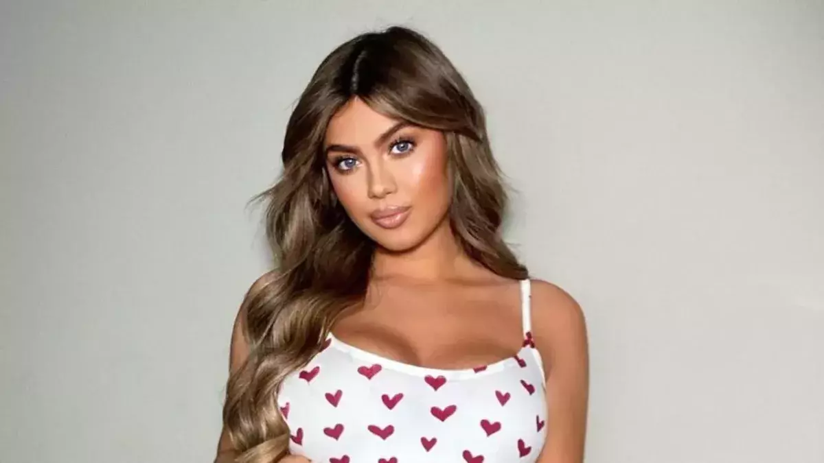 Belle Hassan opens up about attack that left her with a black eye