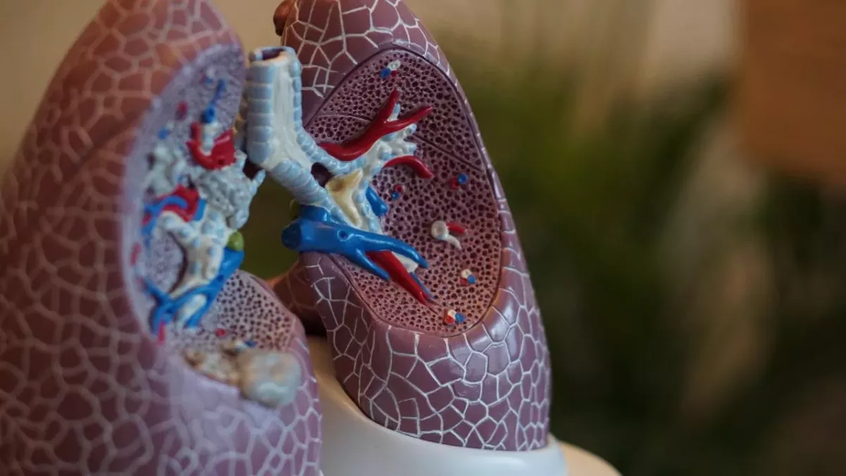 Chelsie Whibley: What is cystic fibrosis, the disease she died fighting?