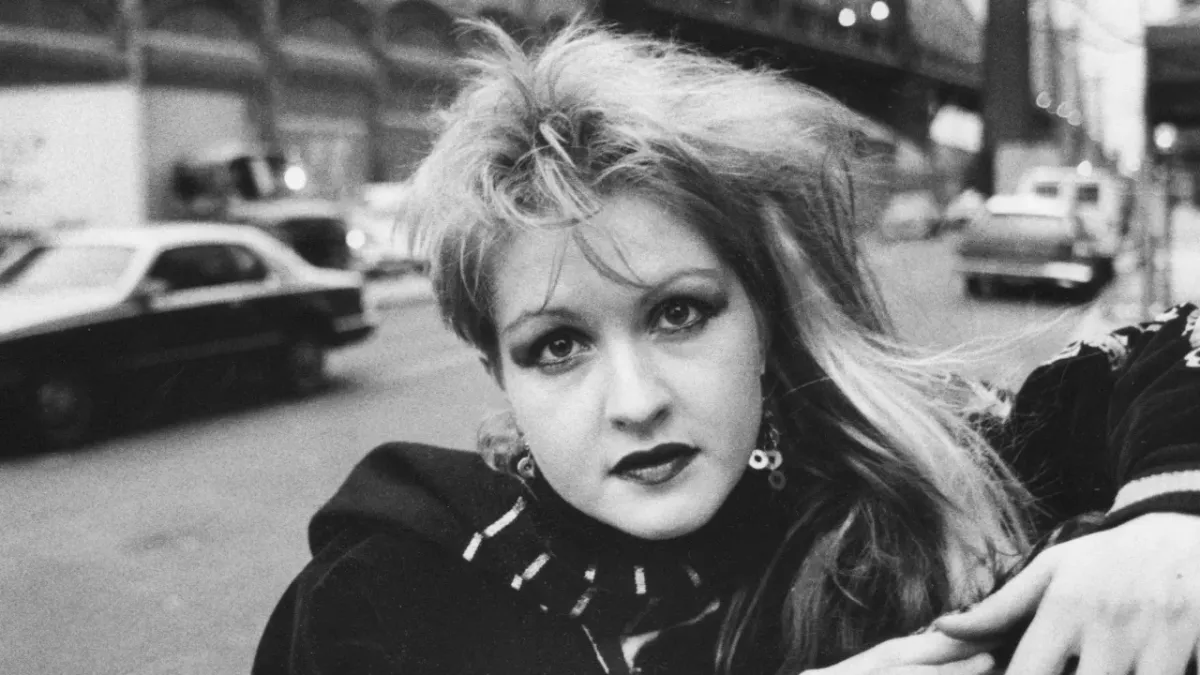 Cyndi Lauper psoriasis