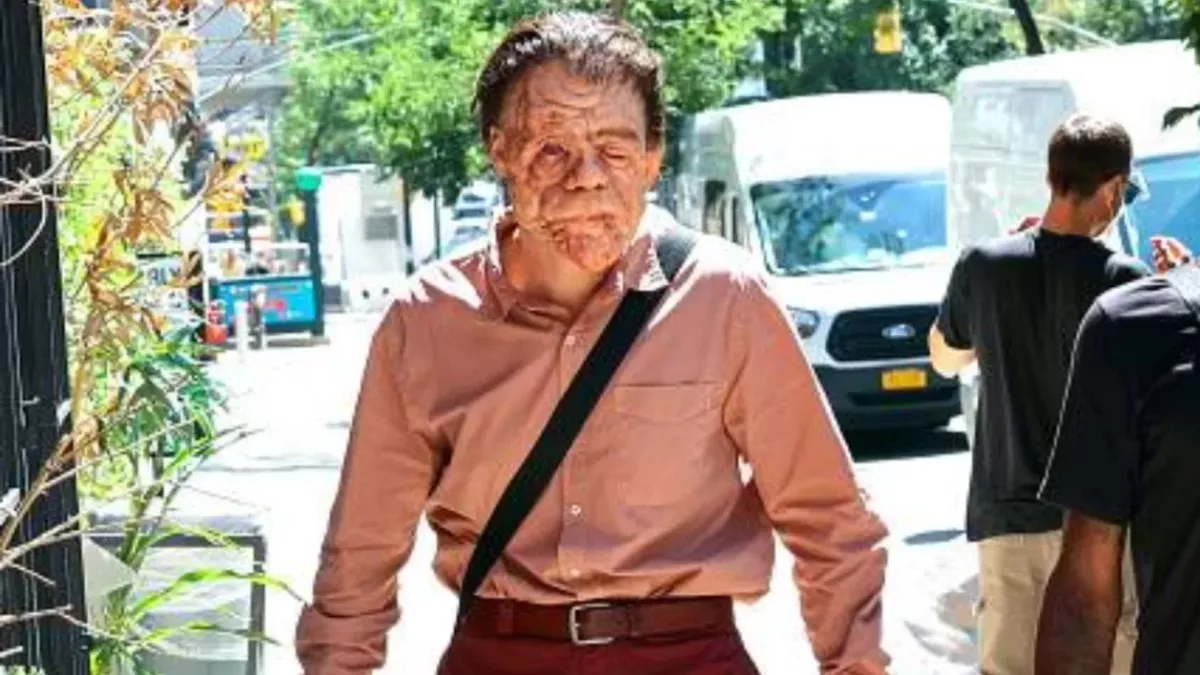 Sebastian Stan dressed as his character from A Different Man