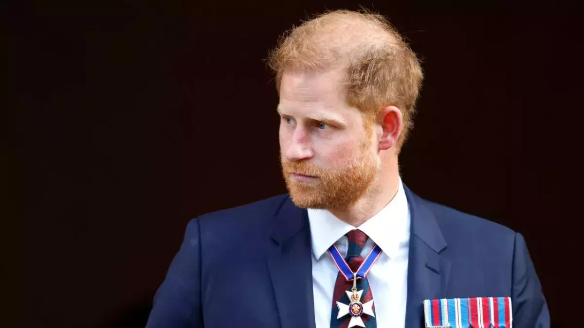 Prince Harry hair loss