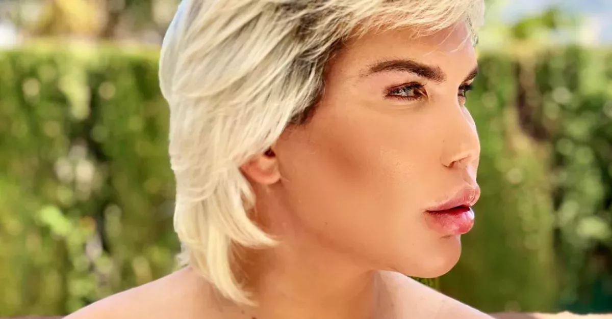 11 Plastic Surgery Operations Later,
