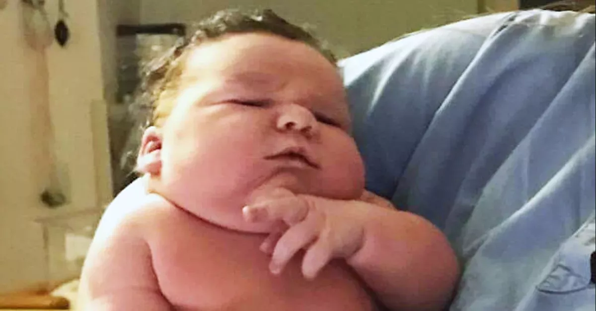Baby When It Was Born Shocked Everyone
