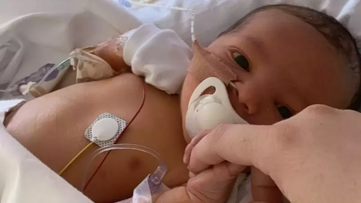 Baby’s stomach balloons up hours after being born, leaving mum scared