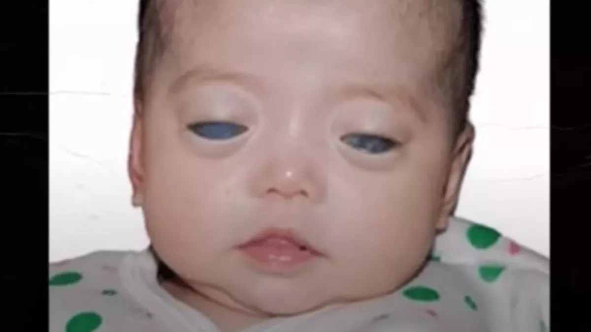 Default image