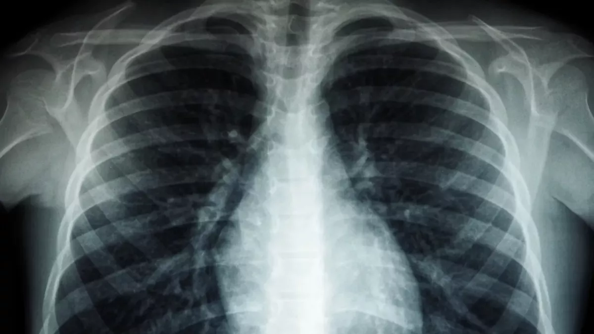 Doctors shocked to find this fragile object inserted in man's anus