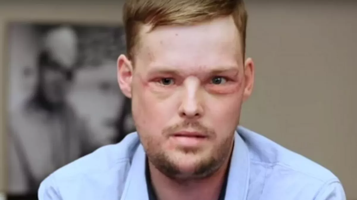 This is the emotional moment a woman met the man who received her late husband's face 