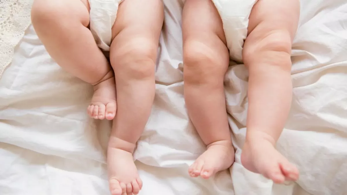 Exceptionally rare 'semi identical' twin babies have bewildered doctors 