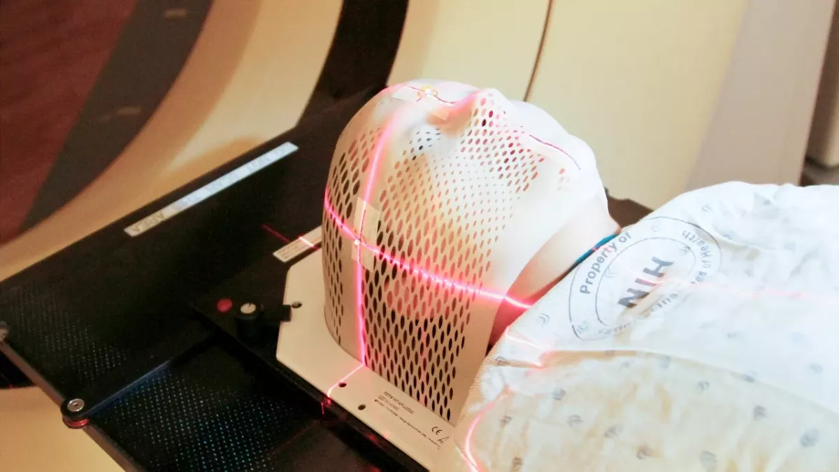 Fist-sized cyst in boy's head 