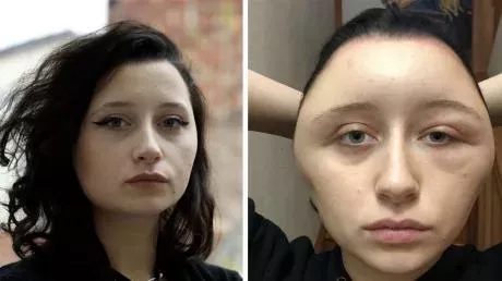 Hair coloring almost killed a girl in France.