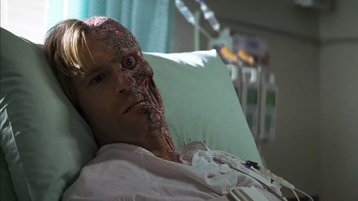 Man with severe burns receives a fish skin graft and the result is rather strange (PHOTO)