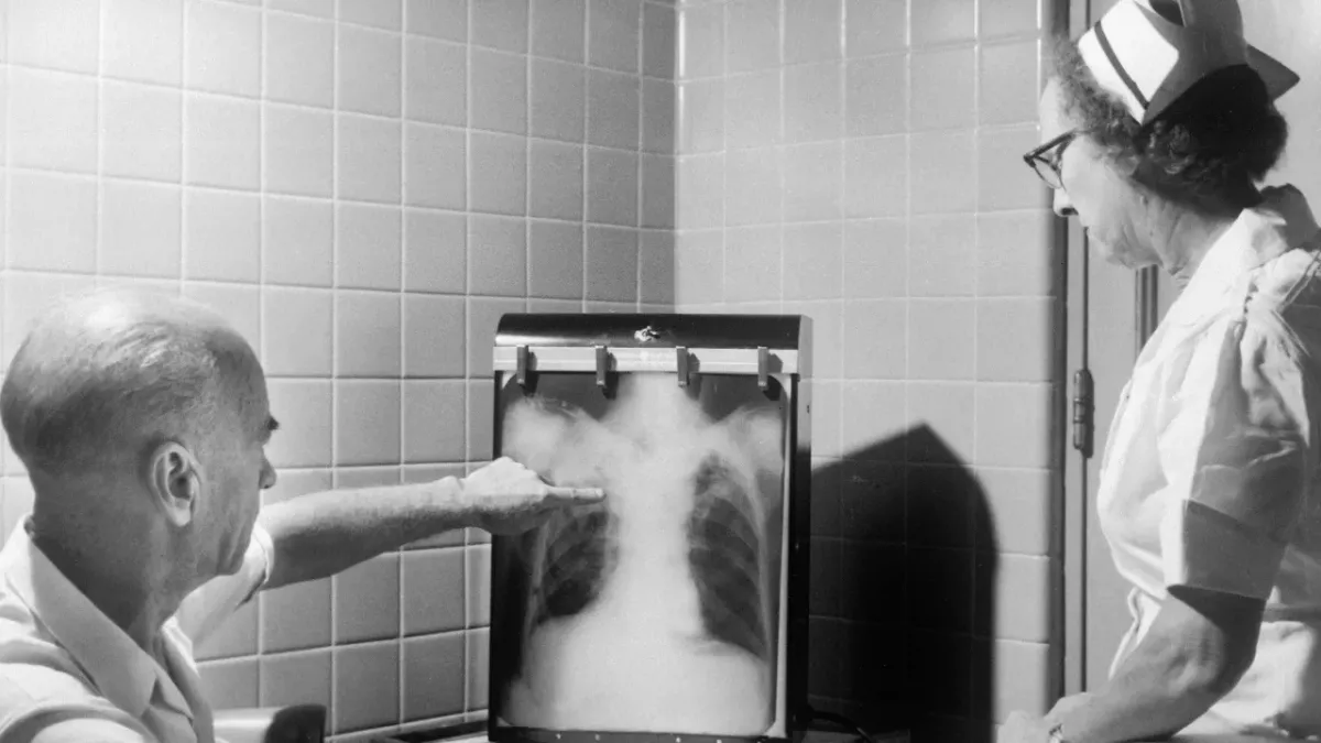 This man was told he had cancer but you would never guess what was really inside his lungs 