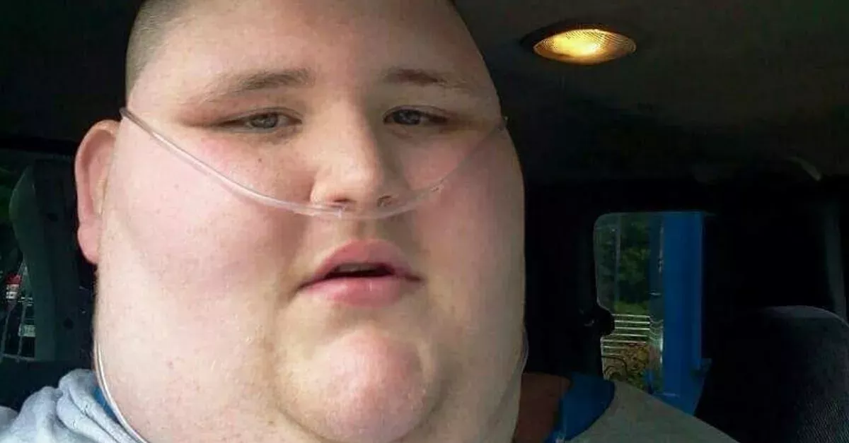 This Obese Young Man's Life Was Hanging By A Thread, 