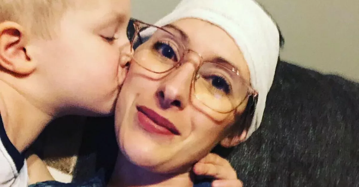 This Pageant Winner Lost Part Of Her Skull Following Devastating Illness