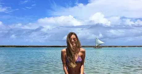 She didn't let her amputation stop her from modeling.