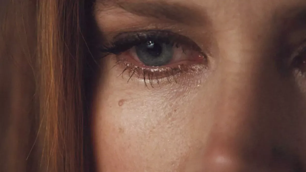 This teenager's face was ravaged by rare flesh-eating ulcers: 'She looks like she's been shot in the face'