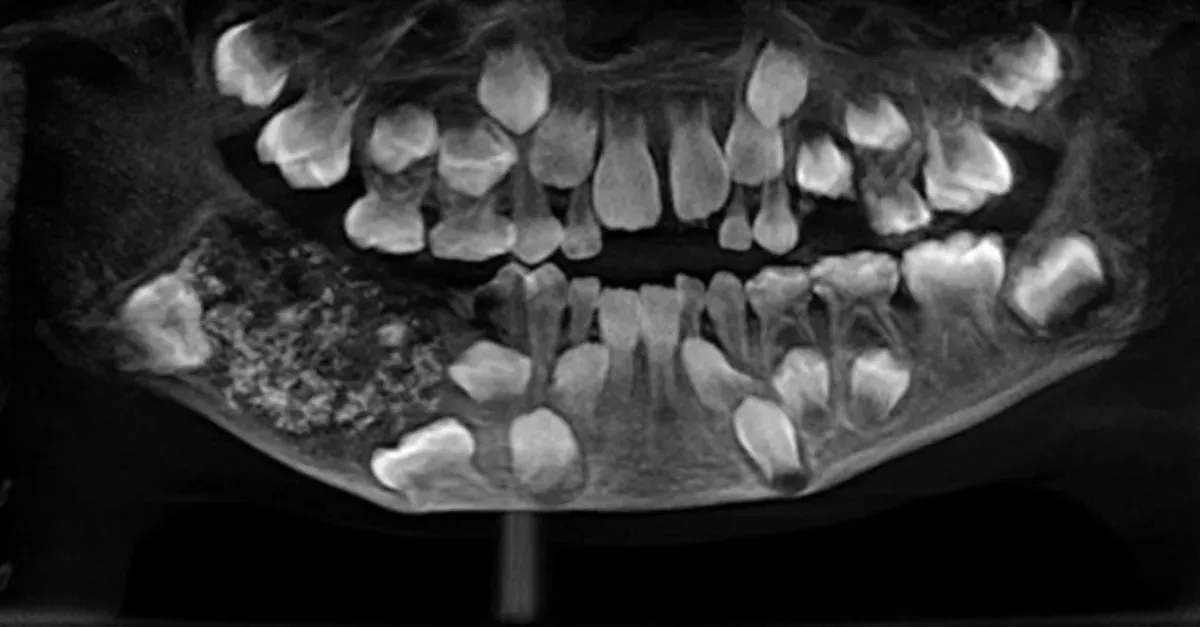 Teeth
