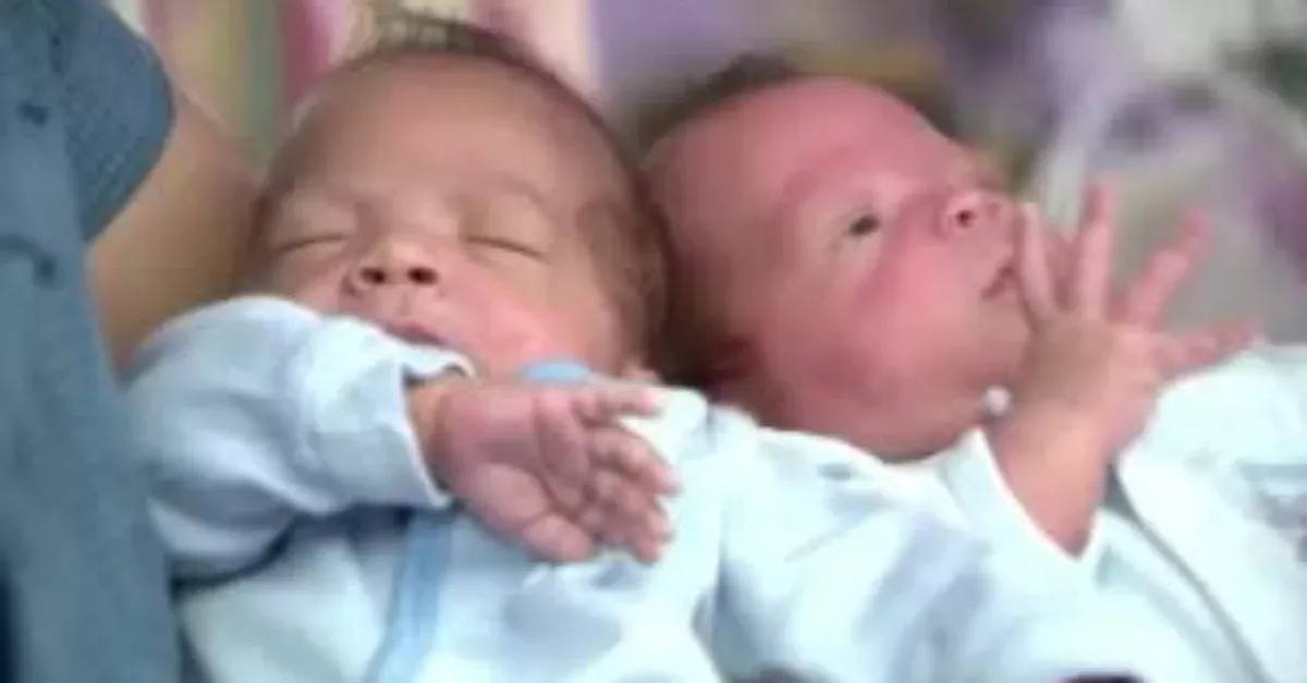 These Two Twins Were Born 24 Days Apart
