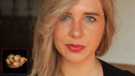 This woman's excruciating period pain was due to something growing inside of her!