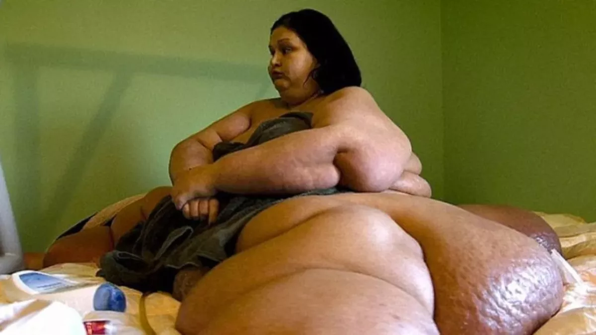 The world’s fattest woman: 57 stone later she's completely changed her life around
