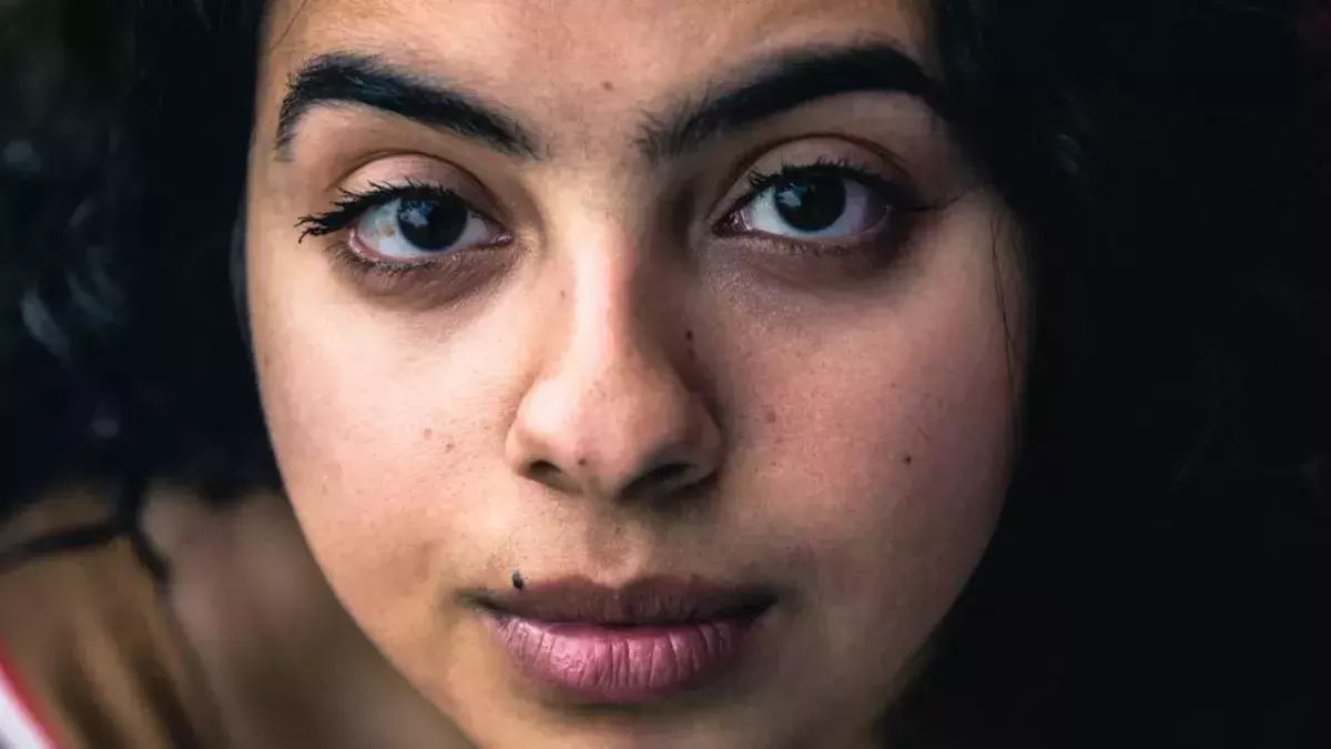8 Amazing Home Remedies to get rid of Dark Spots
