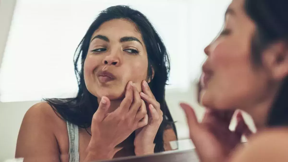 Acne vs Pimples, What’s The Difference?