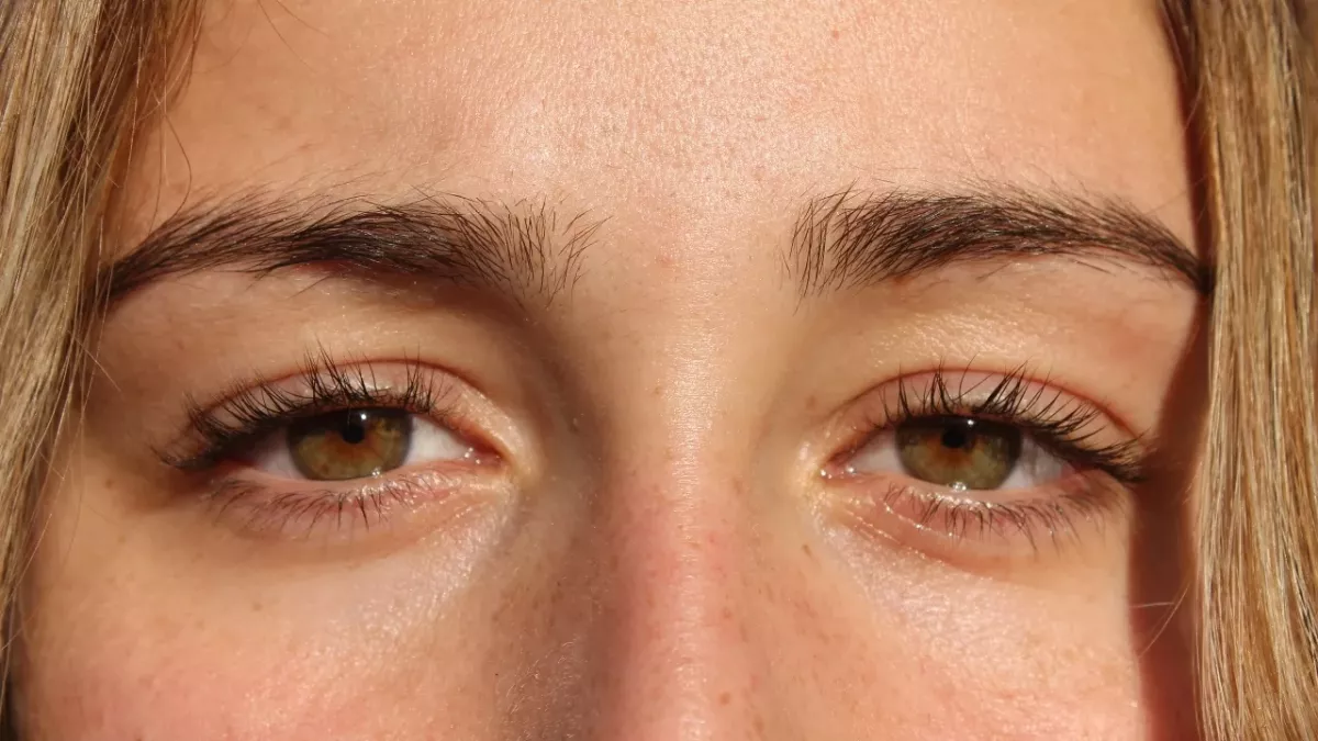 How alcohol affects the skin