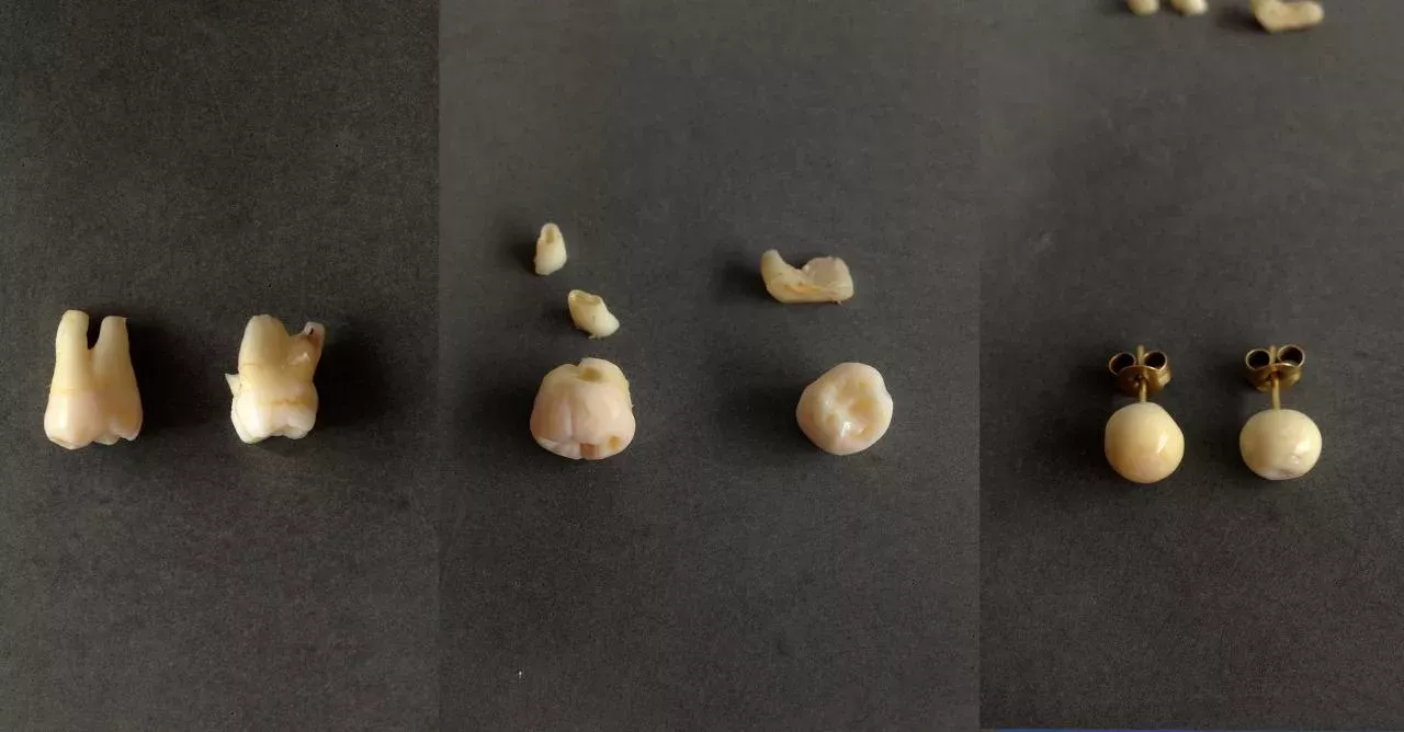 Human Teeth To Fight Against Elephant Poaching
