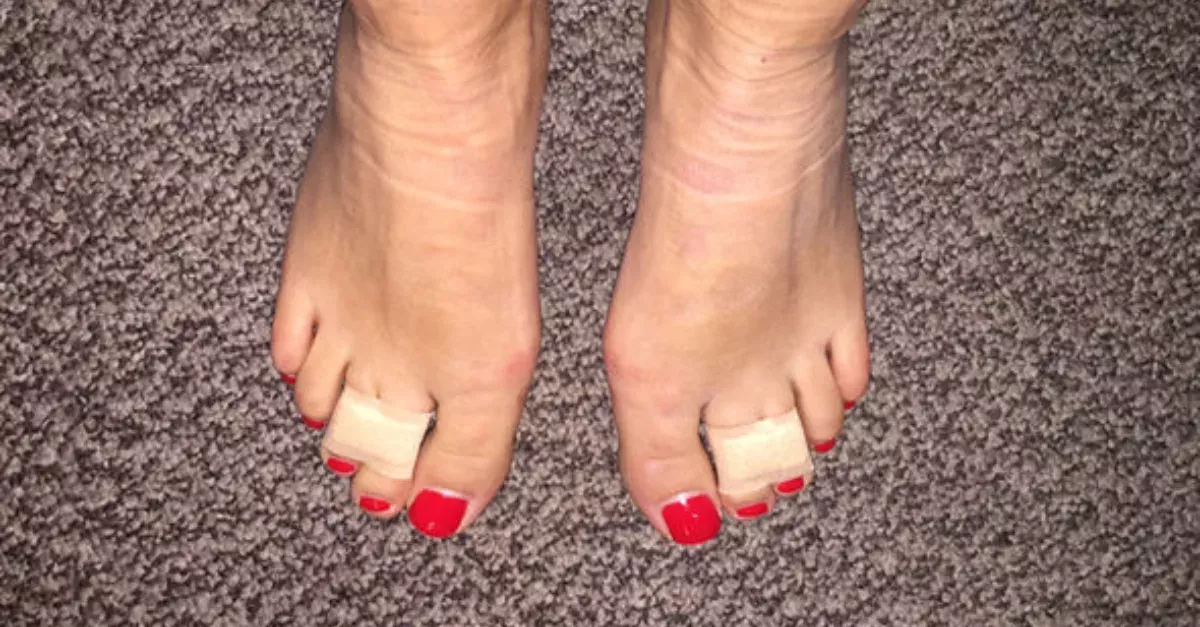 She Ties Her 3rd And 4th Toes Together For An Amazing Reason!