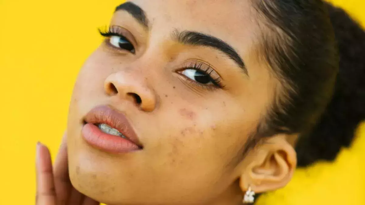 Skinceptance: Superdrug announces new free skin consultation service