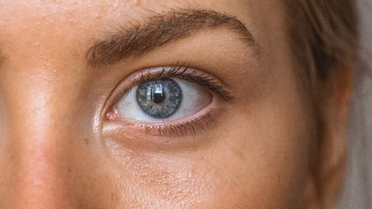 Tips and Tricks: get rid of undereye bags with these 5 tricks 