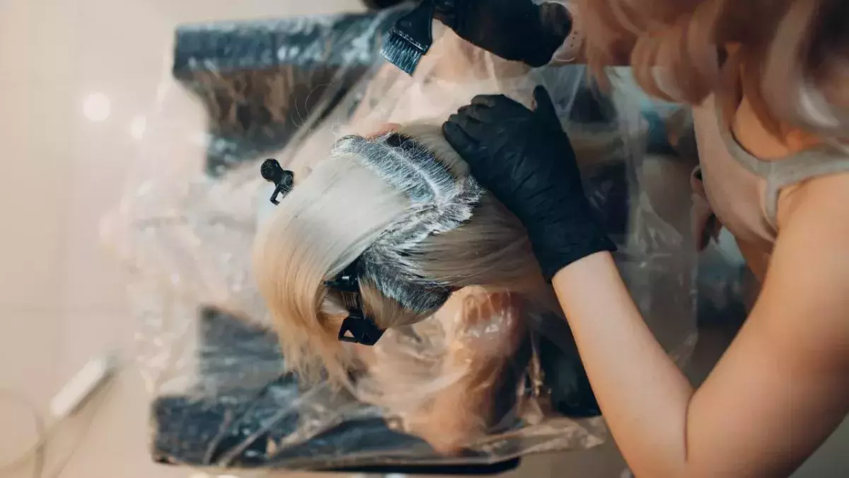 Woman’s head swollen after severe allergic reaction to hair dye