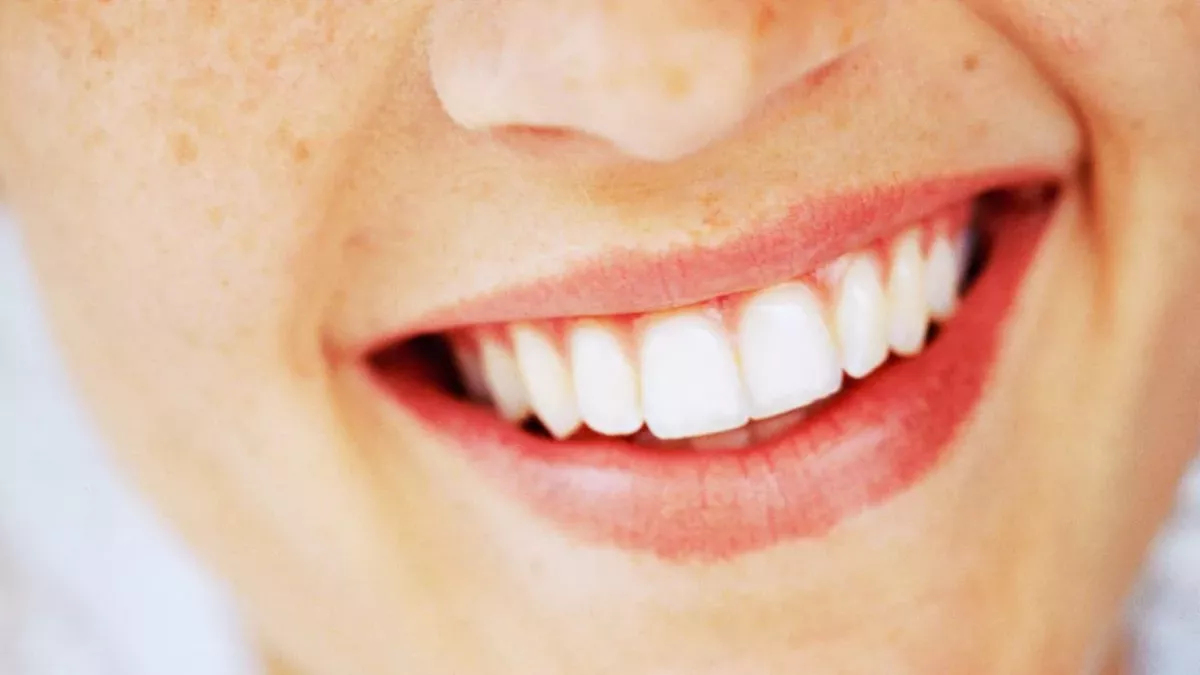These foods can whiten your teeth naturally