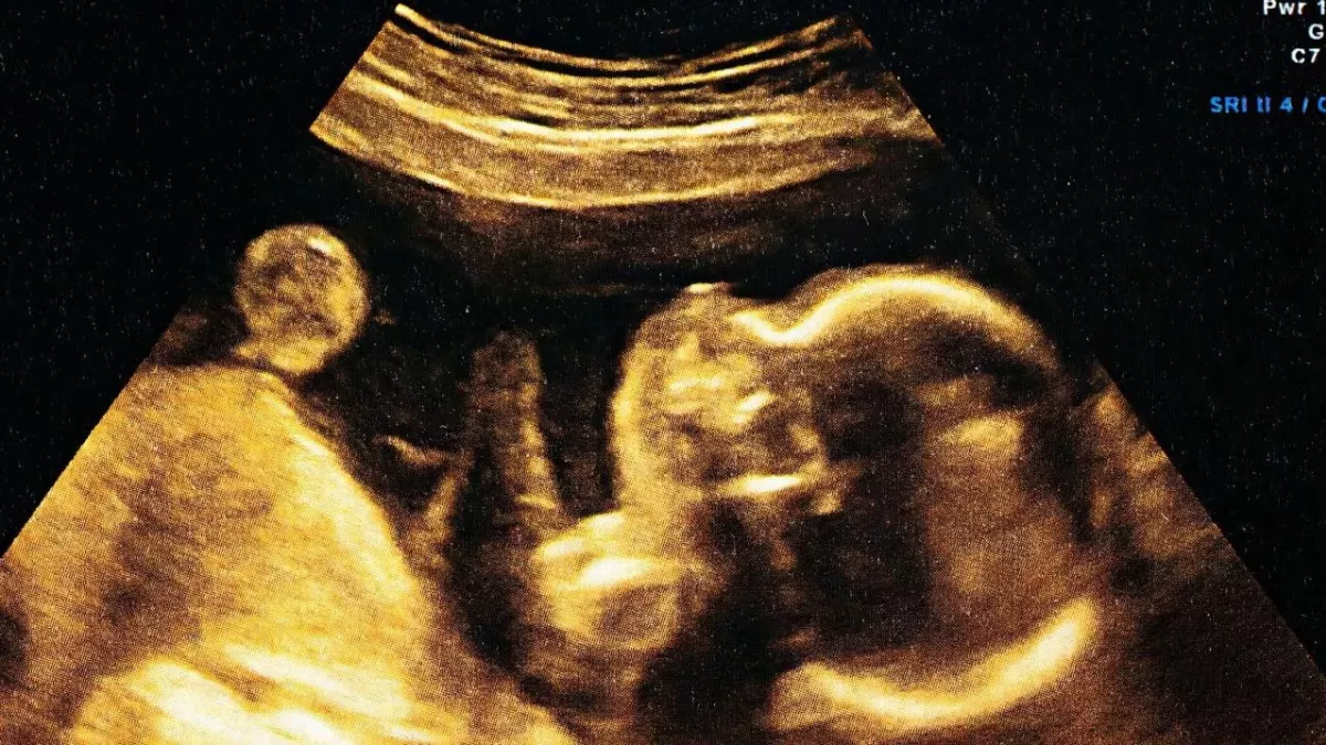Baby scan