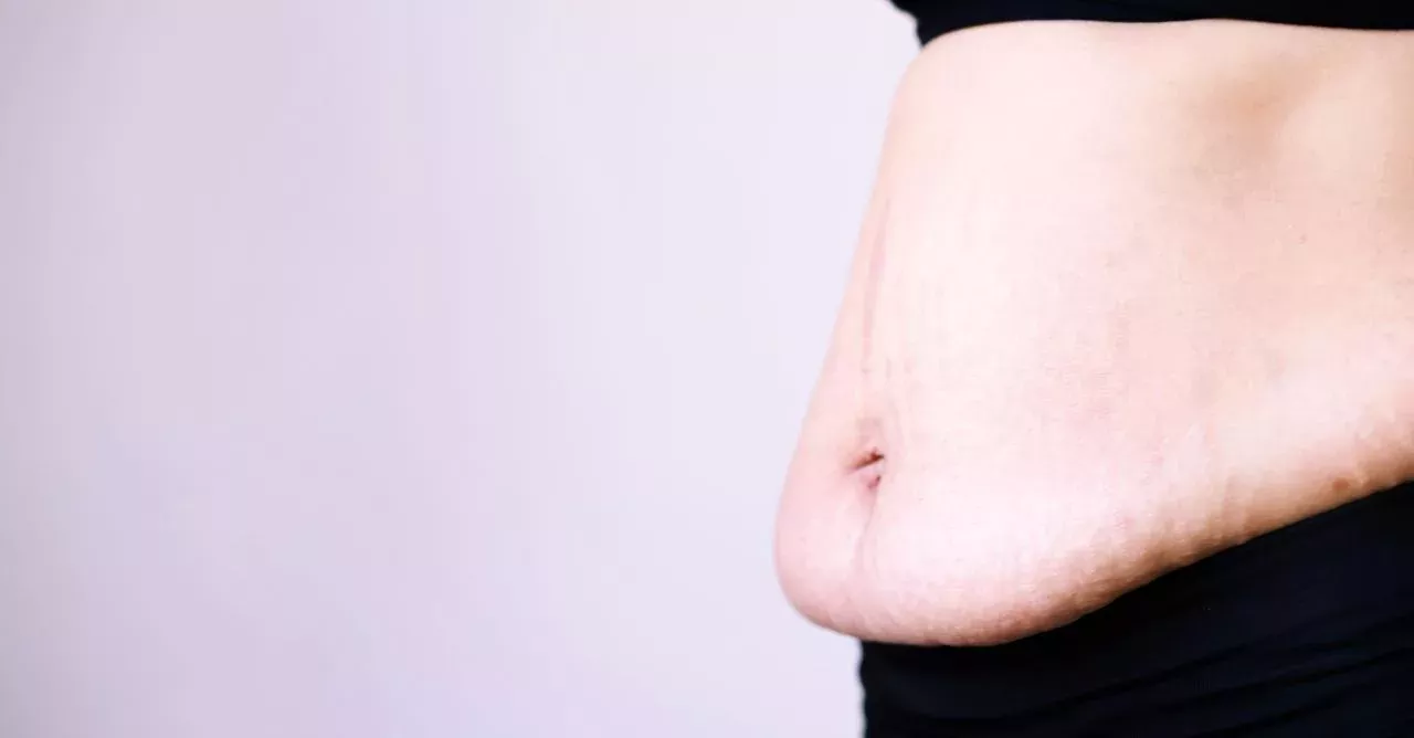 Celebrities And Regular People Are Breaking Postpartum Taboos