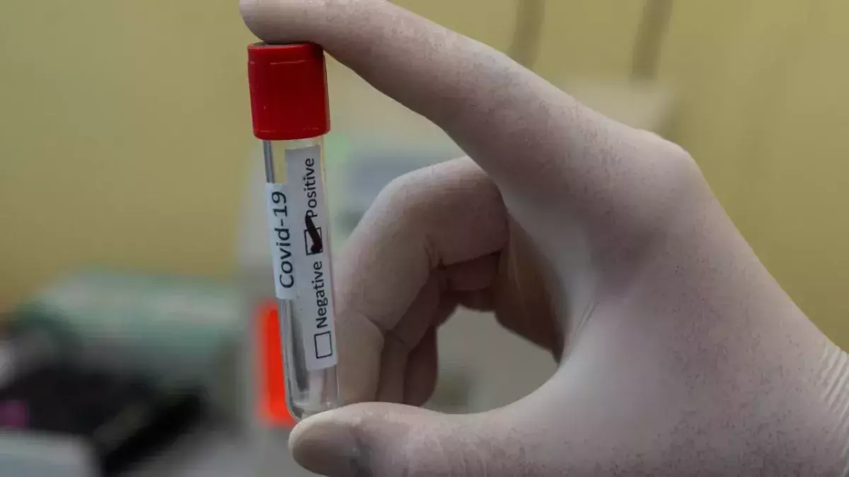 COVID-19: Why is the Omicron variant so contagious?