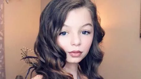 Default image