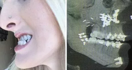 Default image