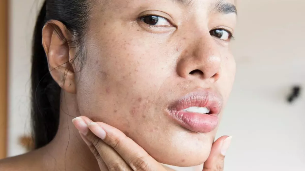 Skin positivity