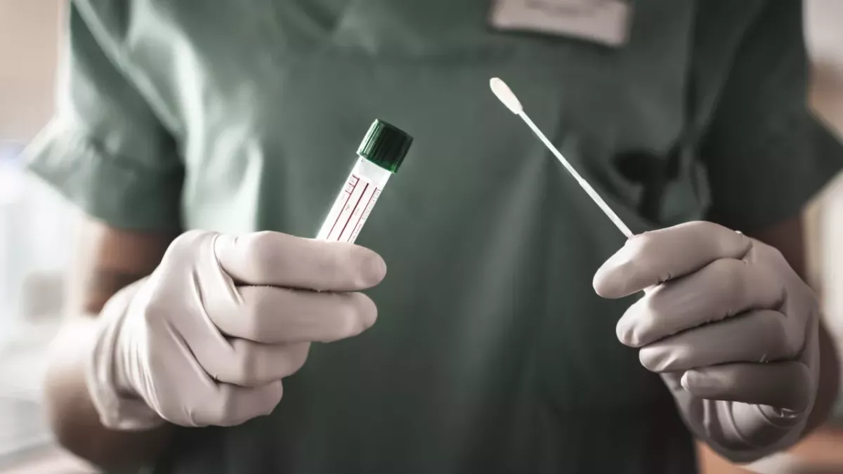 Swab test