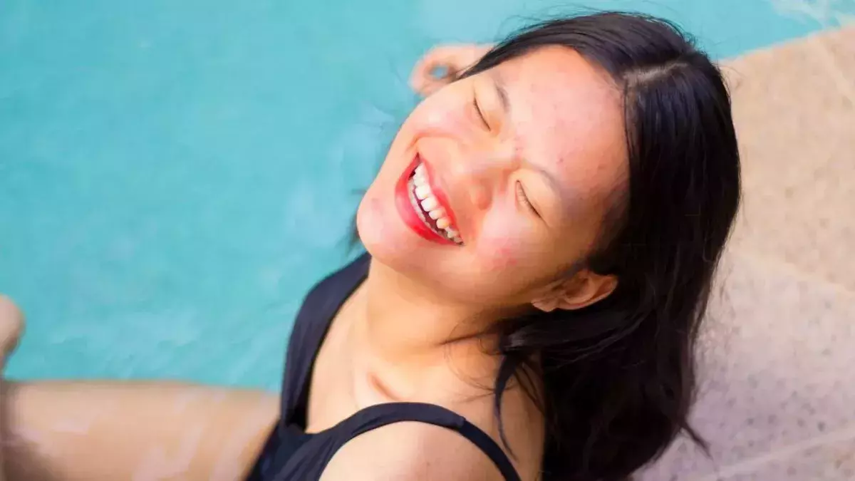 These are five skin positivity influencers you absolutely need to know about 