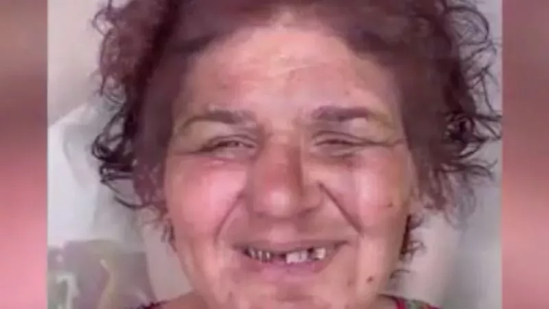 This Woman's Face Changed Drastically After She Underwent A Peculiar And Painful Procedure