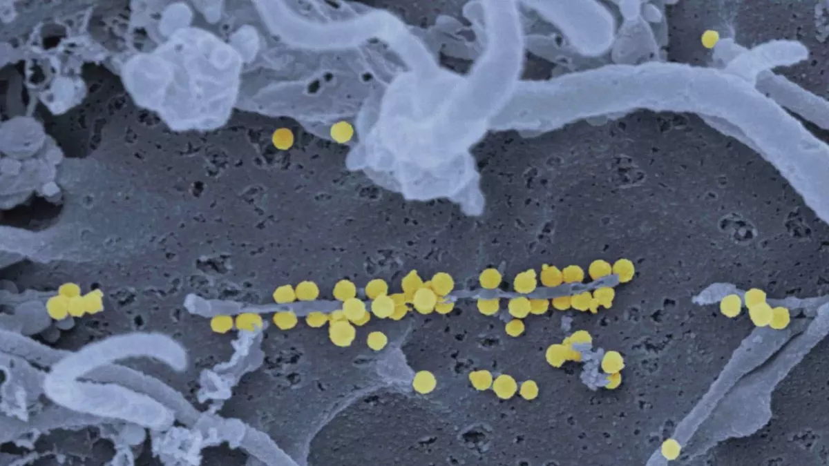 Crimean-Congo Haemorrhagic Fever deadly virus