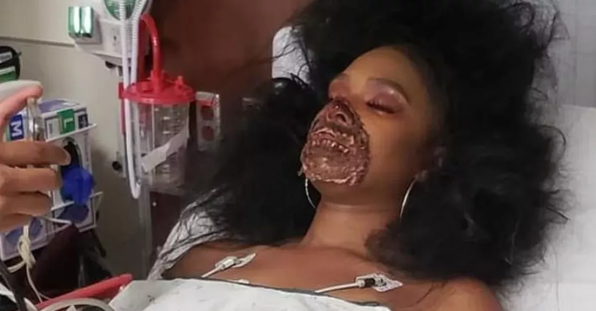 A Dancer In Zombie Makeup Ends Up In Hospital