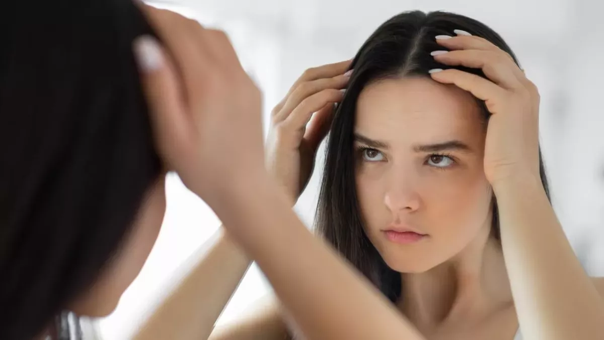 Dandruff unexpected reason it actually happens