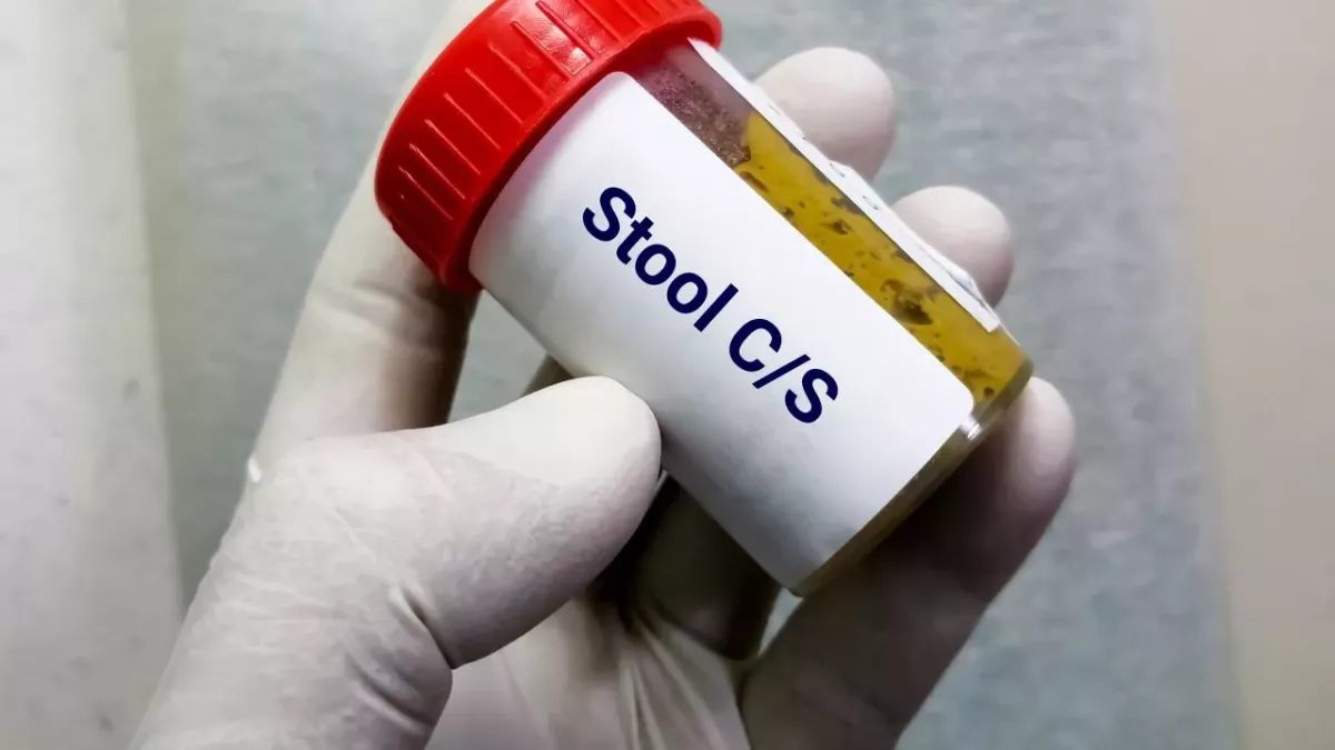 Poo donation: Your poo could help save lives of patients with rare ...