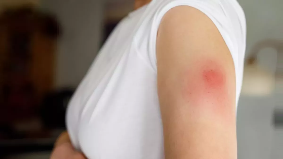 Does Windmilling Your Arm Really Help Vaccine Pain? 