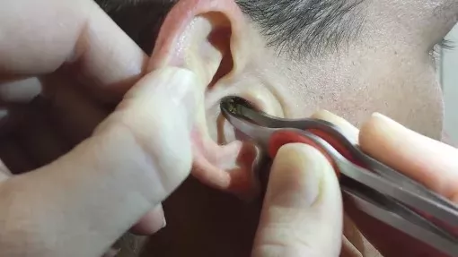 Ear