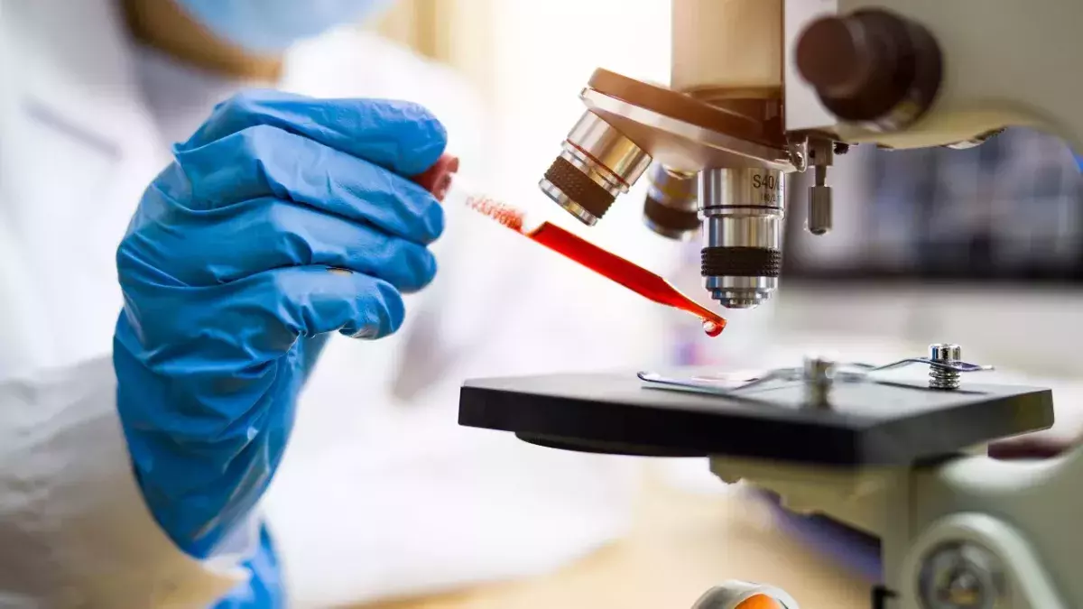 Mexican man dies first ever human case bird flu strain H5N2